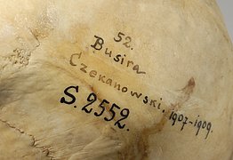 Projektstart zur Erforschung der Herkunft historischer anthropologischer Schädelsammlung bei der SPK