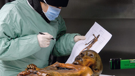 Untersuchung an „Ötzi“ Untersuchung an „Ötzi“